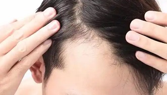 那些 “越努力越社死” 的生发搞笑瞬间