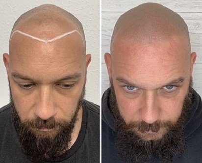 最终效果才是重庆纹发的核心评判标准