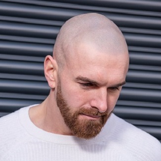 决定重庆纹发效果的绝非简单的 “表皮着色”