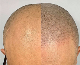 国内纹发技术的核心优势