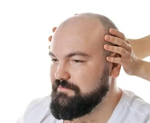 脱发显老，是因为它直接破坏了 “年轻感” 的视觉逻辑