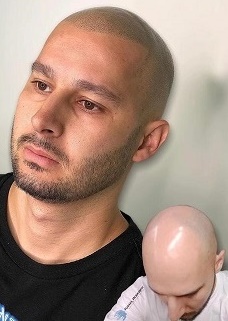 重庆纹发适合群体:精准适配,对症改善 重庆纹发适合群体:精准适配,对症改善