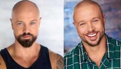 头发多,就一定健康吗? 头发多,就一定健康吗?