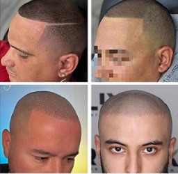 重庆纹发对自信心的恢复核心帮助是什么? 重庆纹发对自信心的恢复核心帮助是什么?