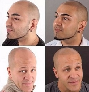 光头纹发如何与自身气质符合？