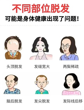 生发的主要难点在哪里？