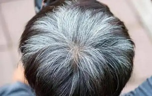 有白发的重庆纹发效果怎么样？